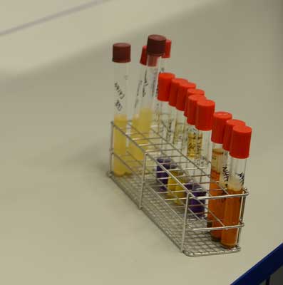 Testkapazitäten steigern: Niedersachsen fördert PCR-Testausstattung für Apotheken